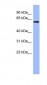 RBM47 antibody - middle region